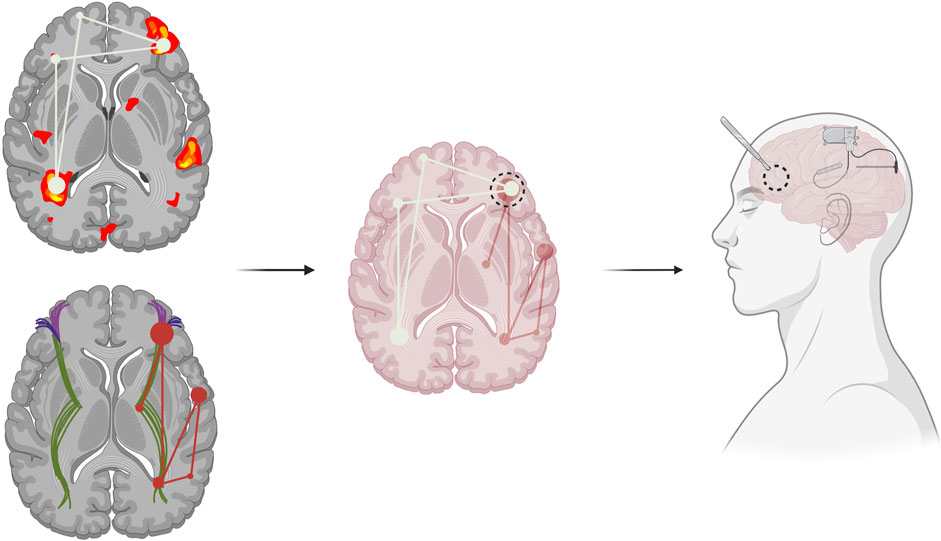 Therapeutic approaches targeting seizure networks
